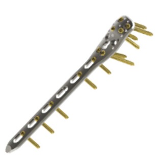 EAGLE?小骨鎖定接骨板系統(tǒng)